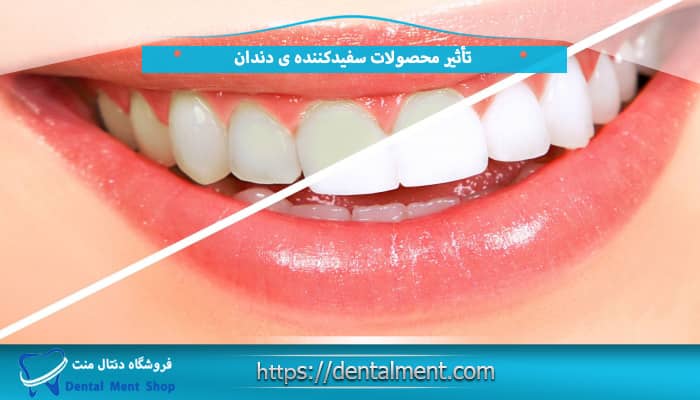 تأثیر محصولات سفیدکننده ی دندان